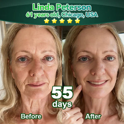 Alisanda® 𝖢𝗁𝗅𝗈𝗋𝗈𝗉𝗁𝗒𝗅𝗅 & 𝑆𝑡𝑒𝑚 𝐶𝑒𝑙𝑙 𝖻𝗈𝖽𝗒 𝗋𝖾𝗇𝖾𝗐𝖺𝗅 𝗌𝖾𝗋𝗎𝗆（𝐿𝑖𝑓𝑡 & 𝐹𝑖𝑟𝑚 𝑆𝑎𝑔𝑔𝑖𝑛𝑔 𝑆𝑘𝑖𝑛 & 𝑅𝑒𝑑𝑢𝑐𝑒 𝑊𝑟𝑖𝑛𝑘𝑙𝑒 𝐹𝑜𝑟𝑚𝑎𝑡𝑖𝑜𝑛